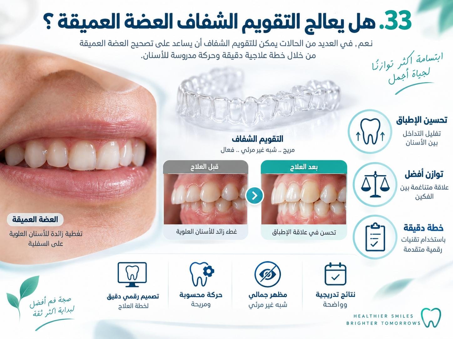 هل يعالج التقويم الشفاف العضة العميقة؟