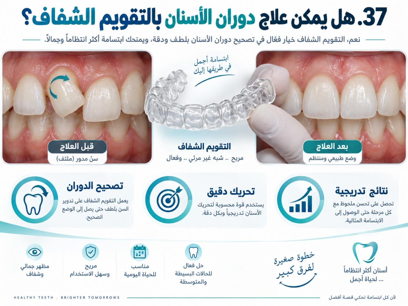 هل يمكن علاج دوران الأسنان بالتقويم الشفاف؟
