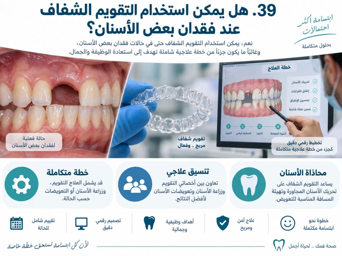 هل يمكن استخدام التقويم الشفاف عند فقدان بعض الأسنان؟