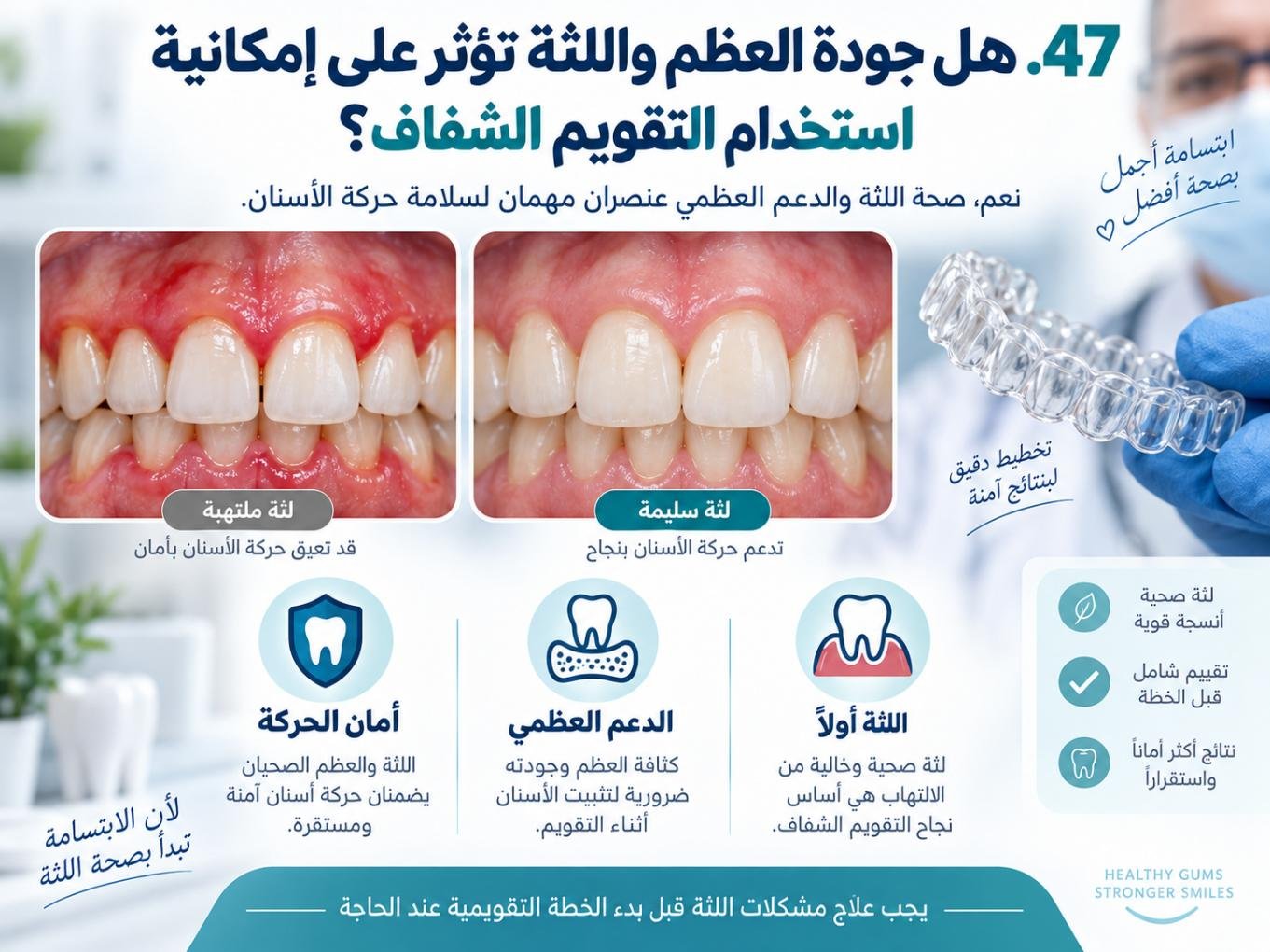 هل جودة العظم واللثة تؤثر على إمكانية استخدام التقويم الشفاف؟