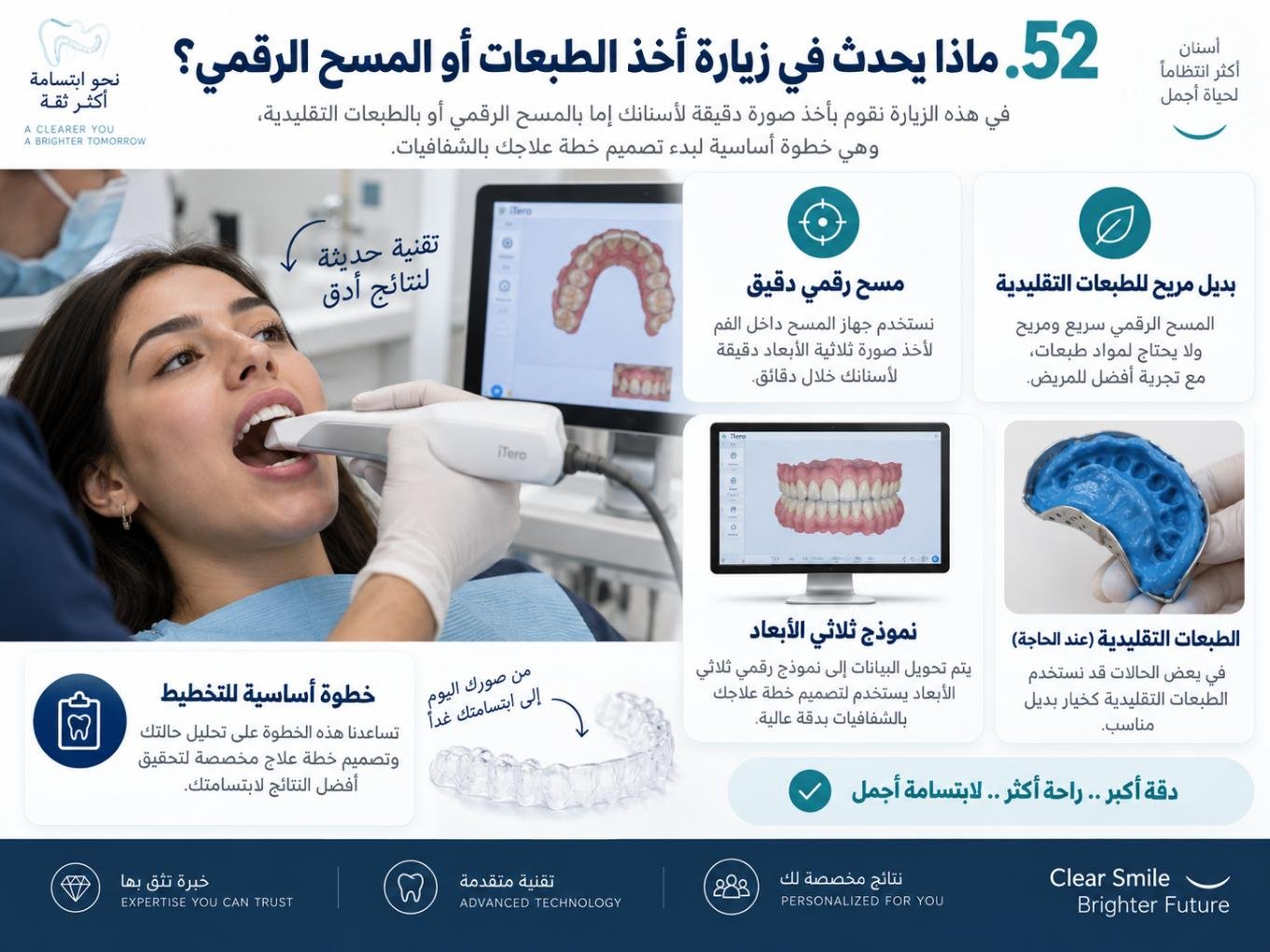 ماذا يحدث في زيارة أخذ الطبعات أو المسح الرقمي؟