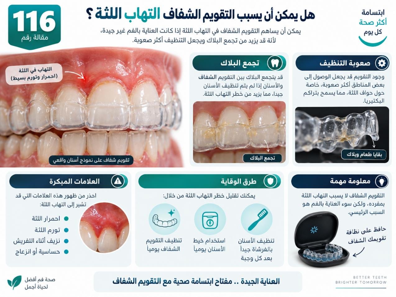 هل يمكن أن يسبب التقويم الشفاف التهاب اللثة؟