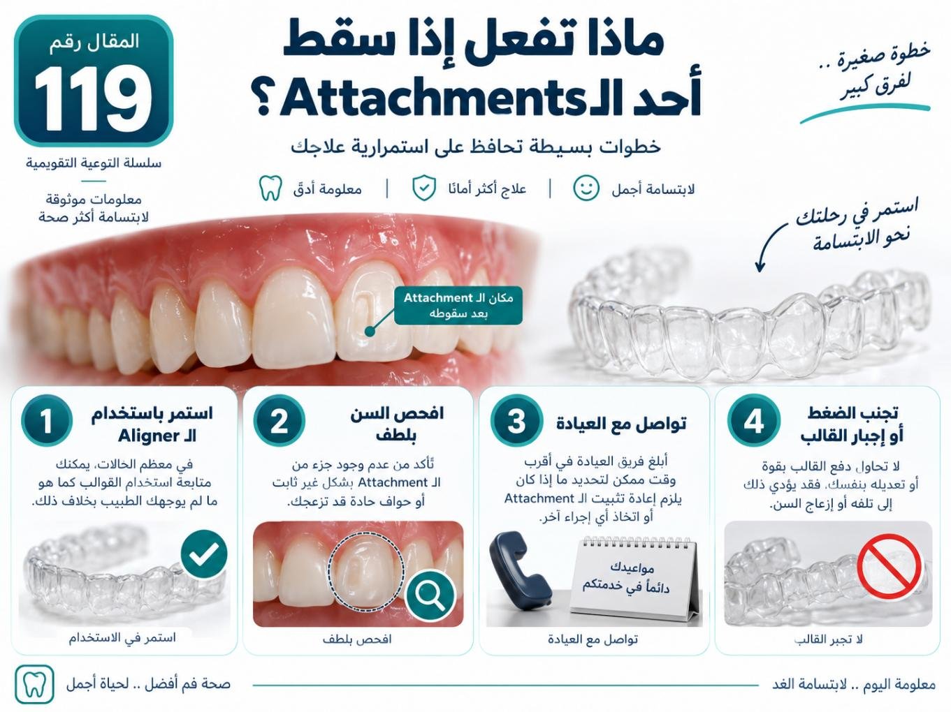 ماذا تفعل إذا سقط أحد الـ Attachments؟