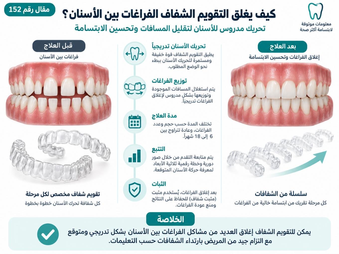 كيف يغلق التقويم الشفاف الفراغات بين الأسنان؟