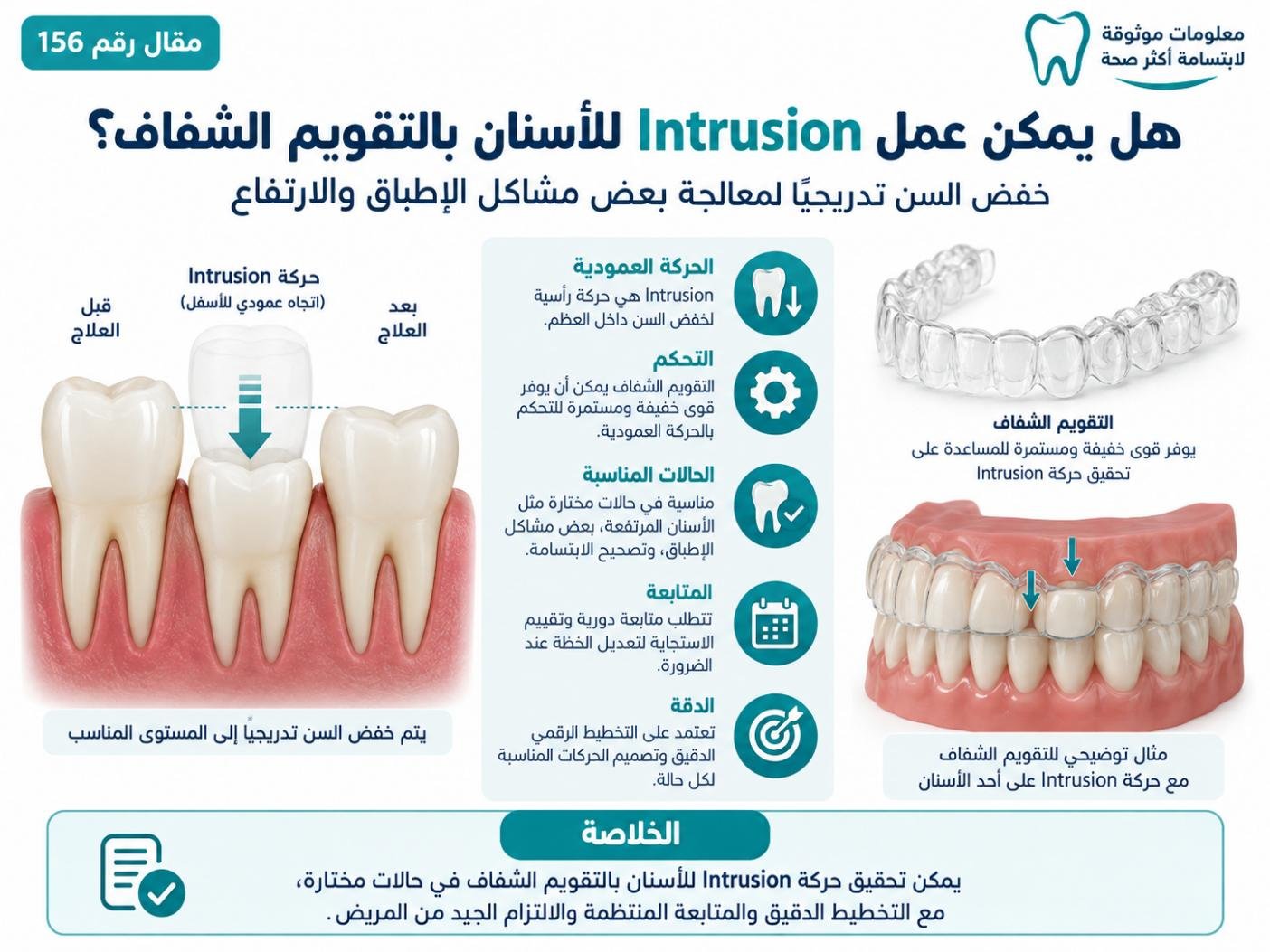 هل يمكن عمل Intrusion للأسنان بالتقويم الشفاف؟
