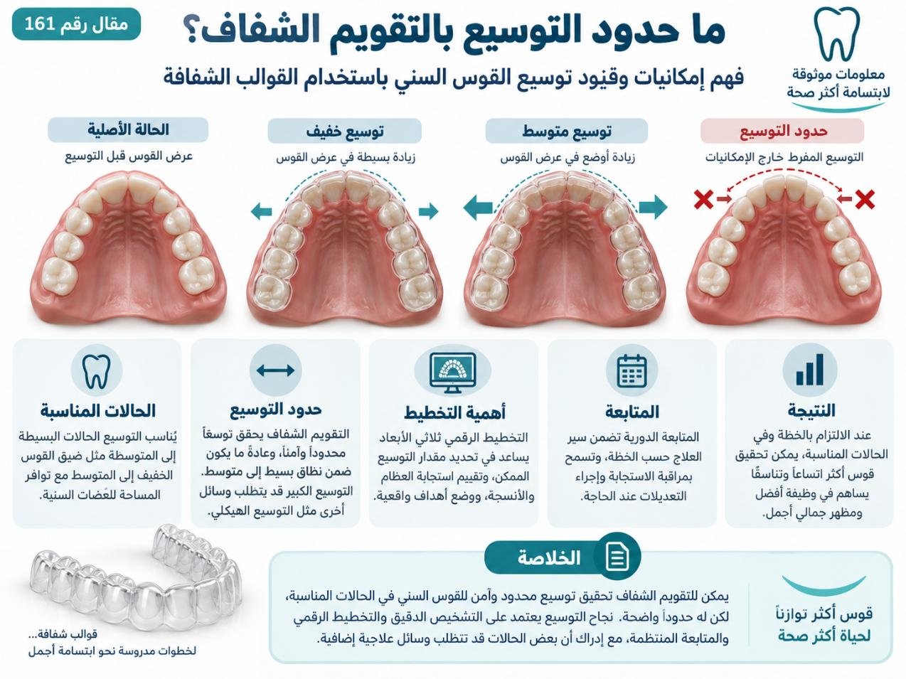ما حدود التوسيع بالتقويم الشفاف؟