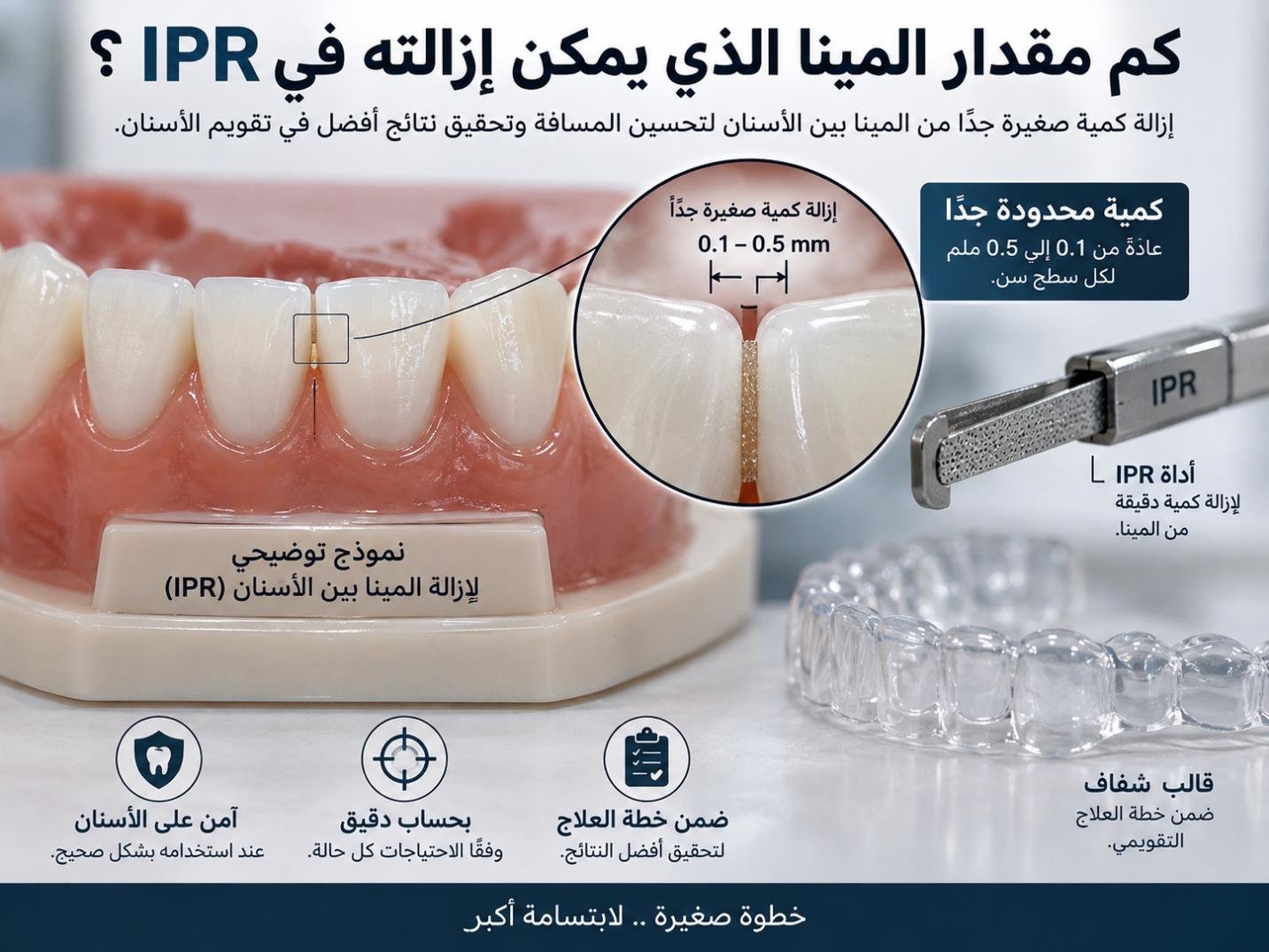 كم مقدار المينا الذي يمكن إزالته في IPR؟