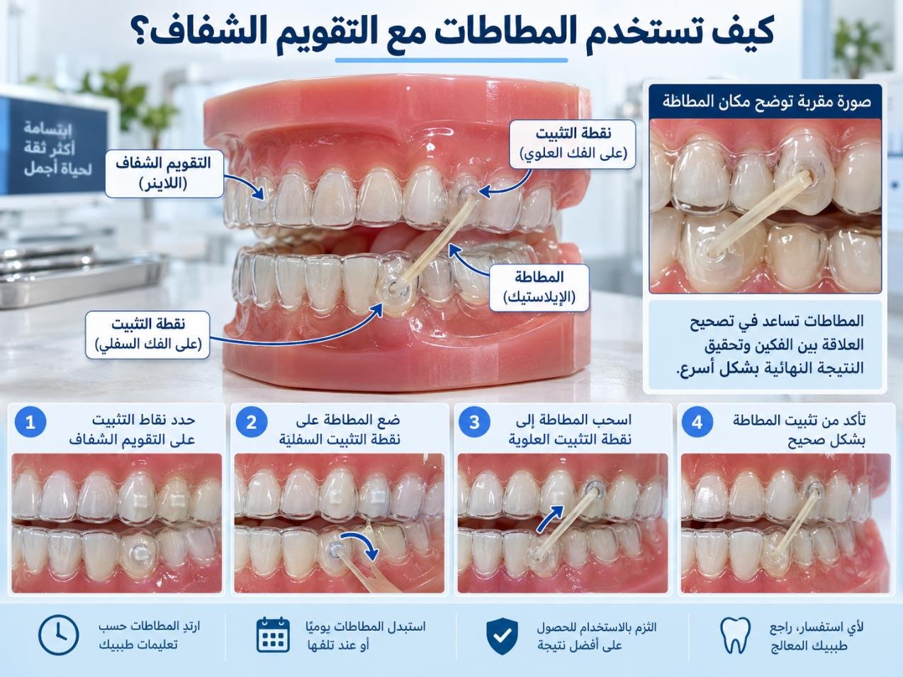 كيف تستخدم المطاطات مع التقويم الشفاف؟