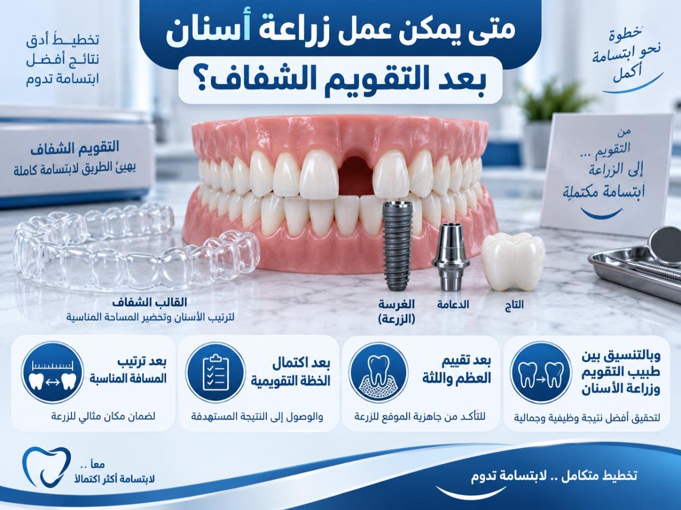 متى يمكن عمل زراعة أسنان بعد التقويم الشفاف؟