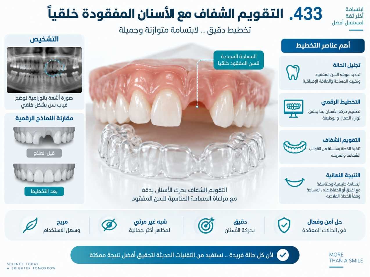 التقويم الشفاف مع الأسنان المفقودة خلقيًا