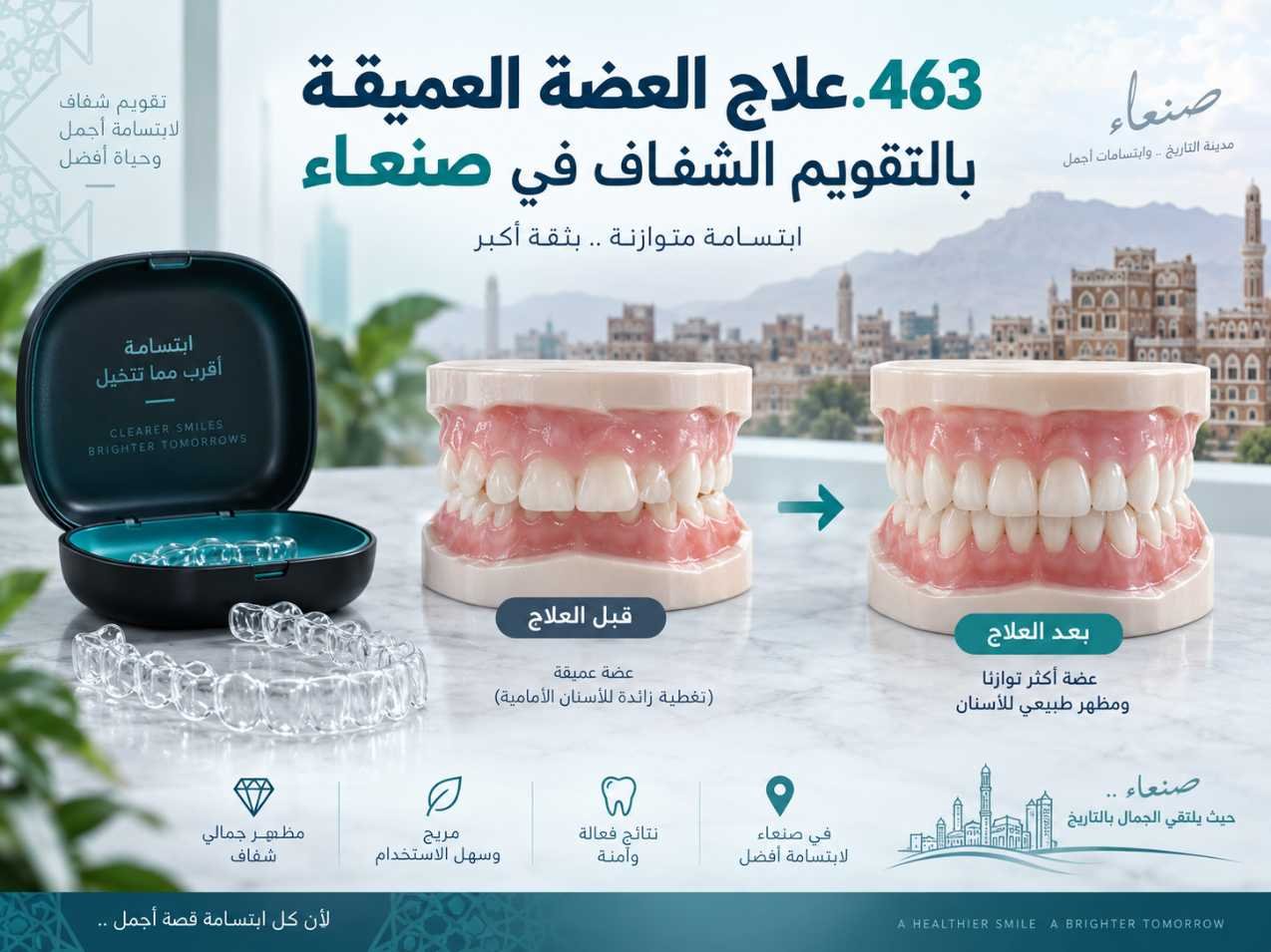العضة العميقة والتقويم الشفاف: كيف تُخطط الحركة؟