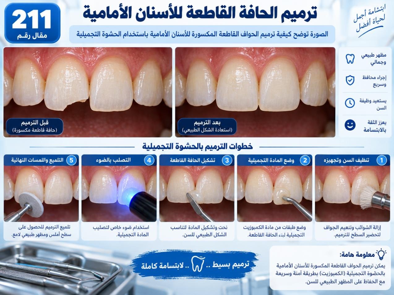 ترميم الحافة القاطعة للأسنان الأمامية: الدواعي والخيارات والعناية
