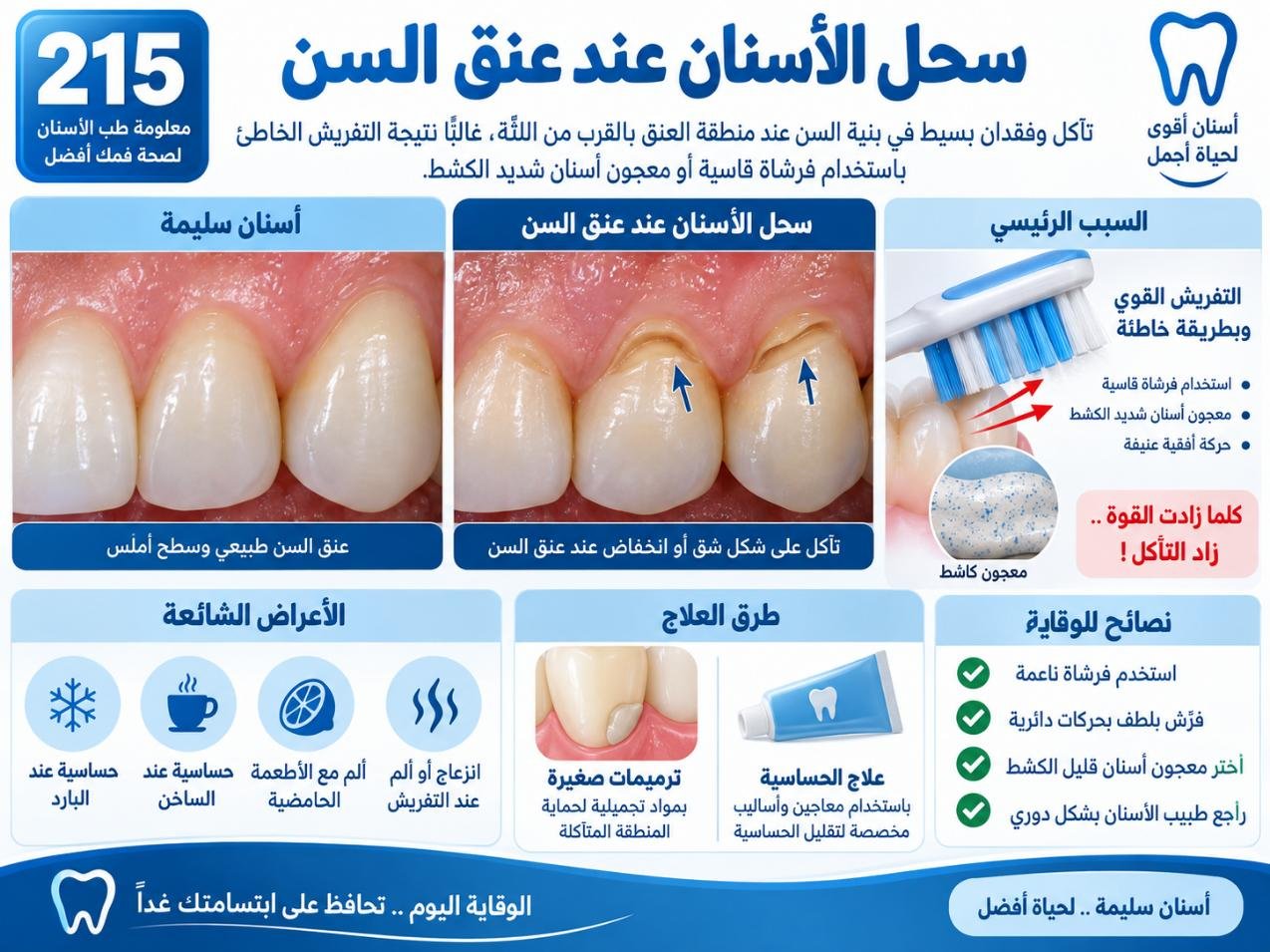 سحل الأسنان عند عنق السن: الأسباب والتشخيص وخيارات العلاج