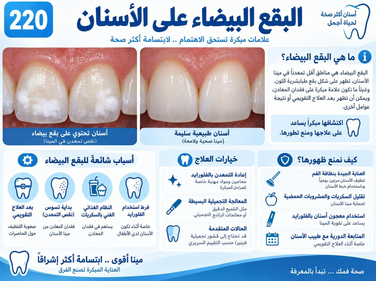البقع البيضاء على الأسنان: الأسباب والتشخيص وخيارات العلاج